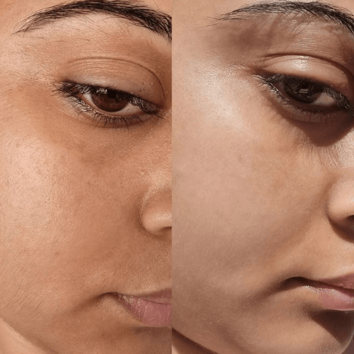 ENCA Skincare Before and After testimonial