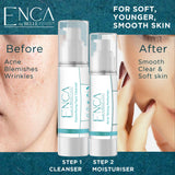 Enca Acne Clearing Set - Cleanser 100ml & Moisturiser 50ml - Enca Skincare by Belle Fever